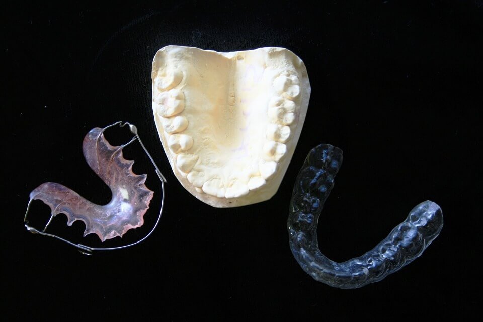 Your dentist in Kanata can help you get relief from migraine pain with mouthguards, retainers, and other treatment options.