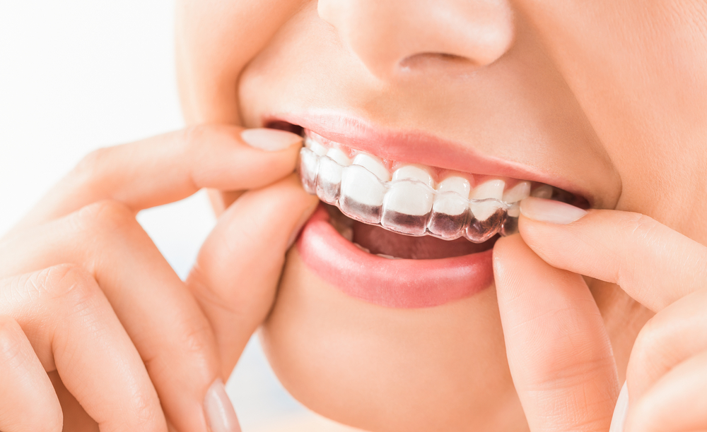 5 Reasons People Use Mouth Guards for their Dental Health