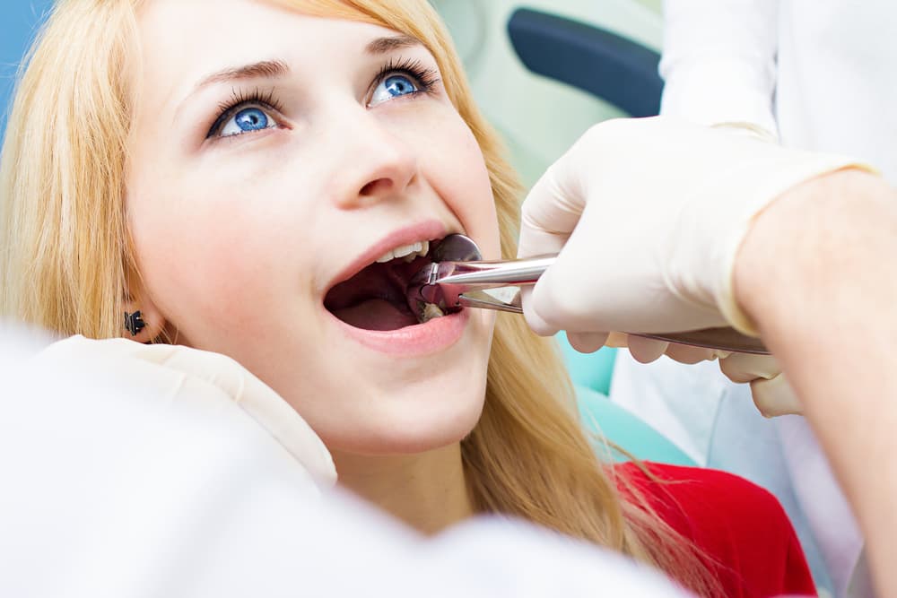 Do I Really Need to Get My Wisdom Teeth Removed?