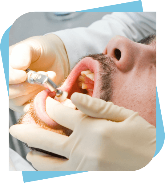 Man having his teeth polished