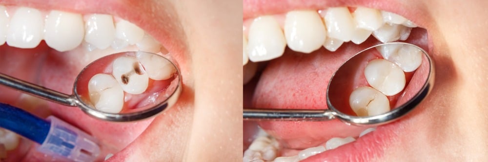 patient receiving emergency dental treatment