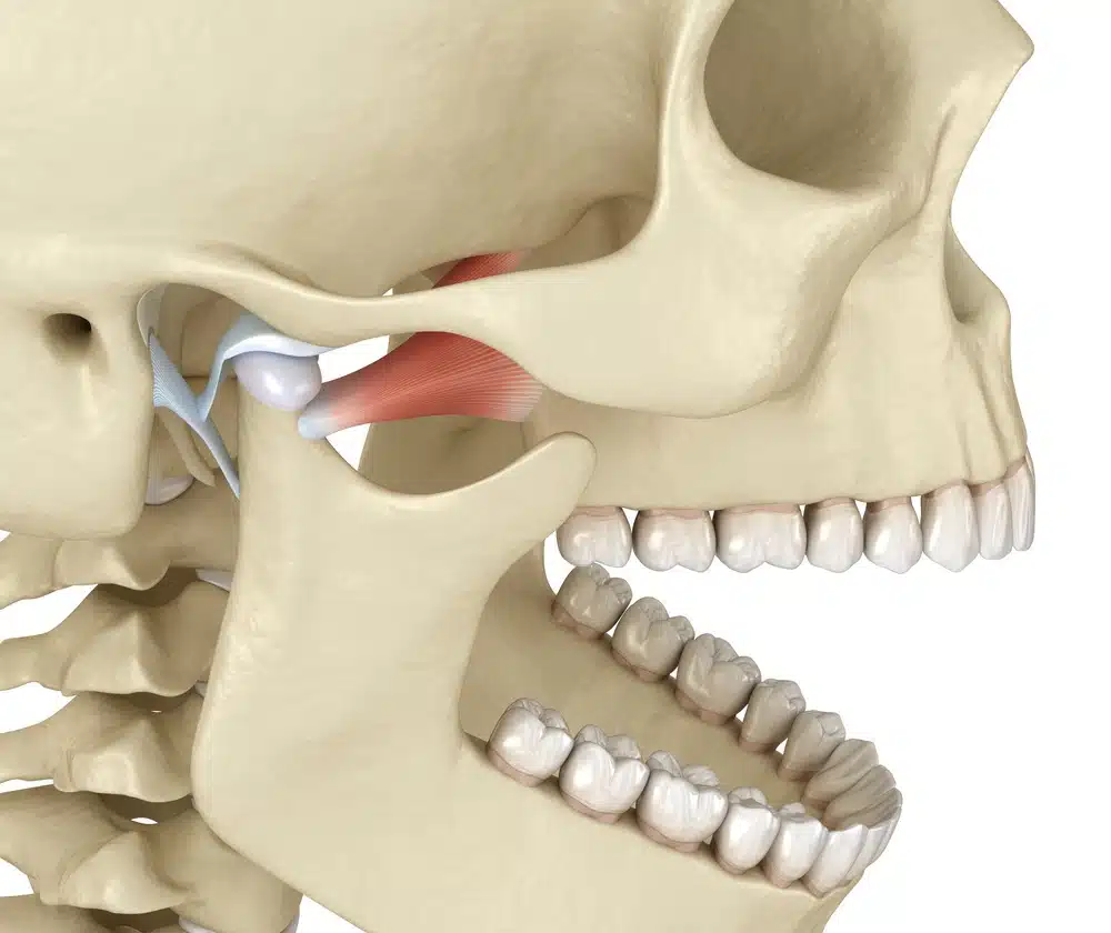 animation of TMJ TMD jaw issues